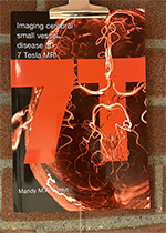 ISBN: 9789461081544 - Title: Imaging cerebral small vessel disease at 7 Tesla MRI